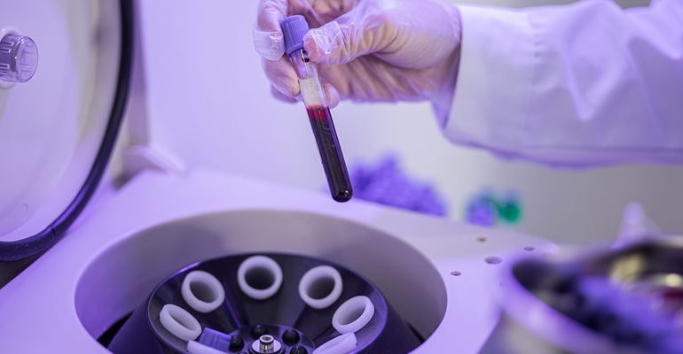 Industrial Centrifuges in Healthcare: A Vital Role in Laboratory Testing