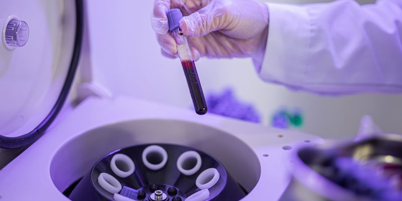 Industrial Centrifuges in Healthcare: A Vital Role in Laboratory Testing